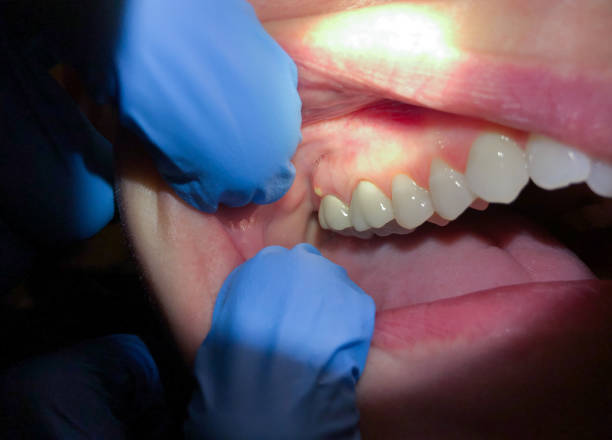 Best Mobile Emergency Dentist in Hlcrest, IL